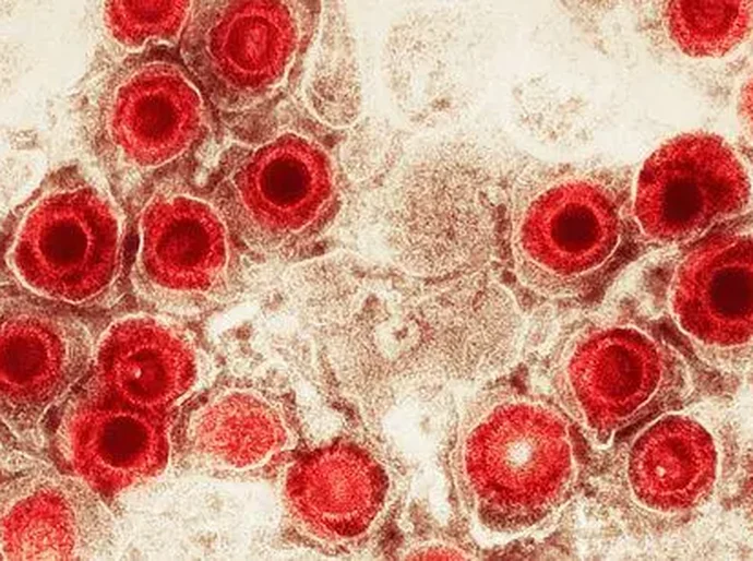 Vírus comuns podem aumentar o risco de Alzheimer?
