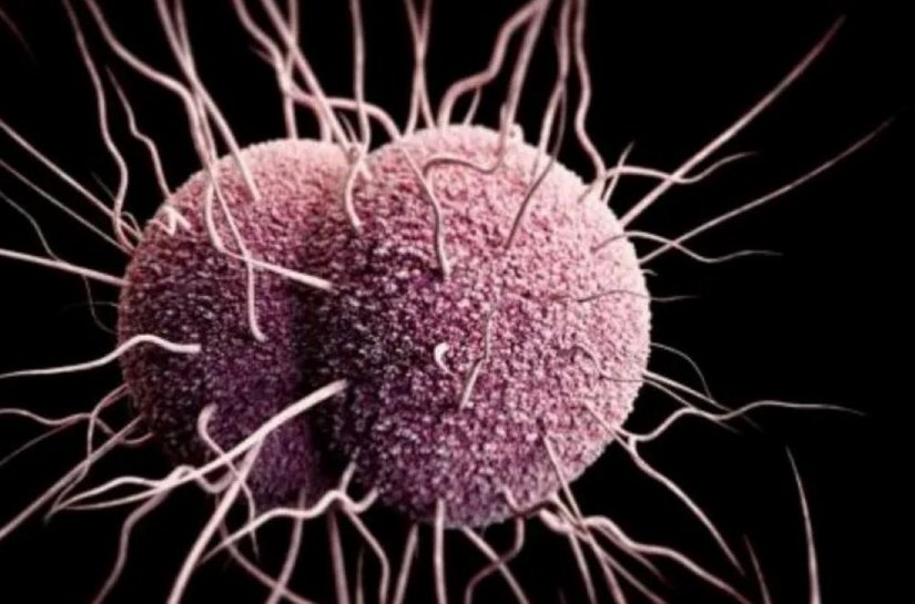 EUA registram primeiros casos de gonorreia resistente a antibióticos
