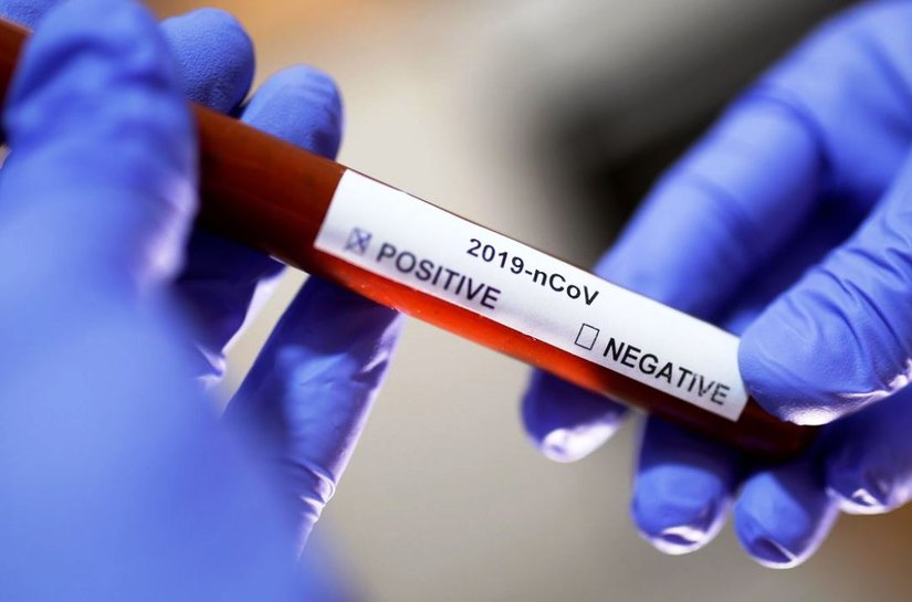 Covid-19: Brasil tem 123,7 mil mortes e 3,99 milhões de casos