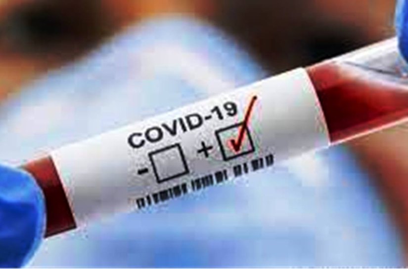 MT registra 515.218 mil casos da Covid 19 e 13.397 nesta quarta feira, 25