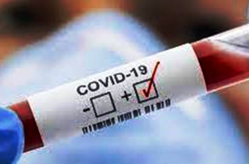 MT registra 384.443 mil casos da Covid 19 e 10.464 mil mortes, nesta segunda, 17