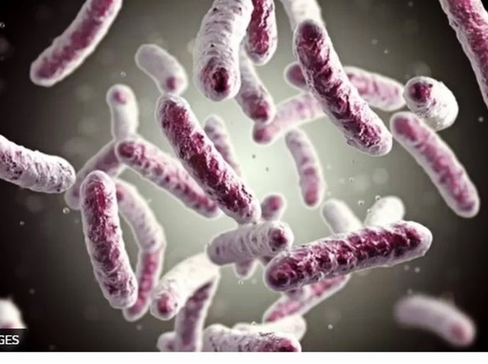 Doença dos legionários: cientistas desvendam o que está por trás de surto de 'pneumonia misteriosa' na Argentina