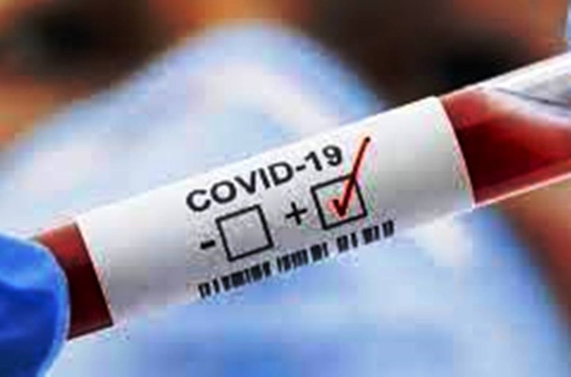MT registra até quarta feira, 09, 422.148 mil casos da Covid 19 e 11.303 mil mortes