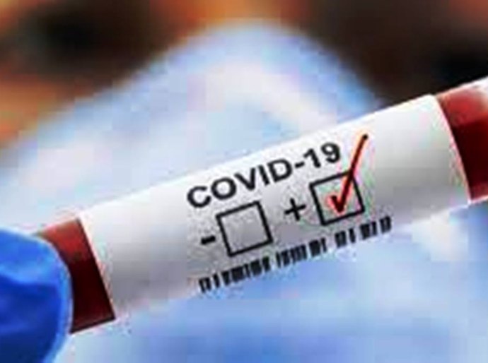 MT registra 363.366 mil casos da Covid 19 e 9.805 mil mortes até sábado, 01