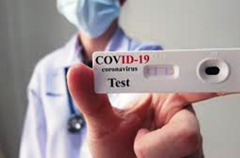 Veja Documento: ANS obriga a partir desta segunda feira, 29, a Unimed Cuiabá, a Pax, o MT Saúde e o Geap de fazerem teste da Covid 19