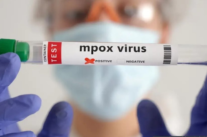 Brasil supera marca de mil casos de mpox em 2024