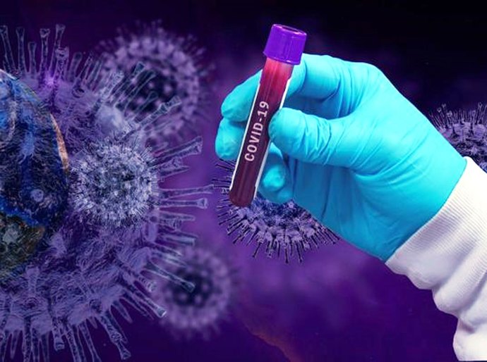 Mato Grosso tem 146.312 mil casos da Covid 19 e 3.903 mil mortes nesta sexta feira, 06