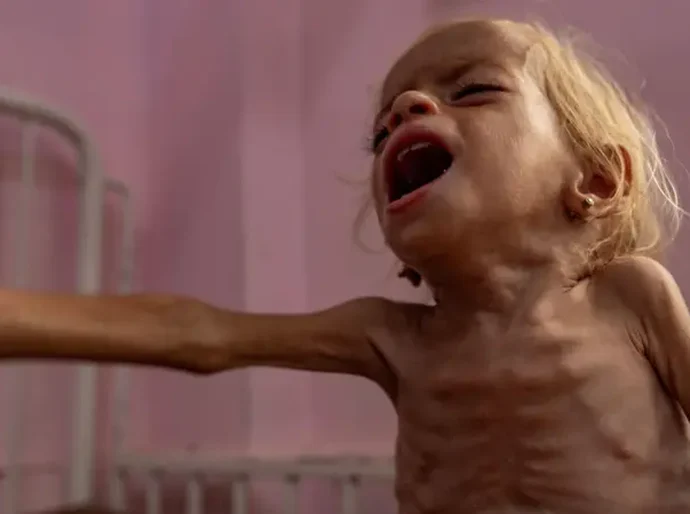 Fome é confirmada na Cidade de Gaza pela primeira vez, diz órgão ligado à ONU