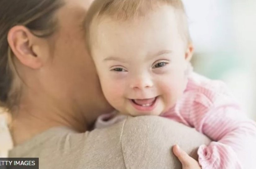 Como queda de nascimentos de bebês com Down virou pivô da disputa entre grupos pró e contra aborto na Europa