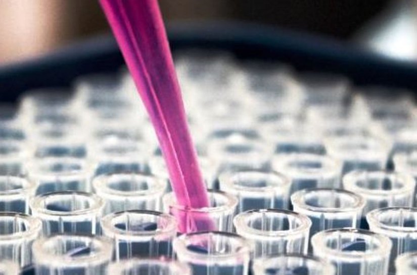 MT entra em queda no número de infecções e mortes da Covid 19, o Novo Coronavírus