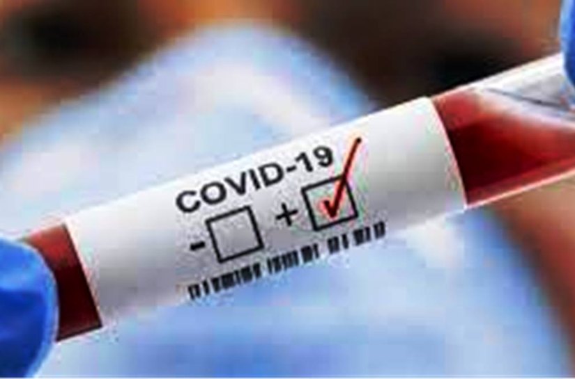 MT tem até domingo, 27, 448.308 mil casos da Covid 19 e 11.926 mil mortos