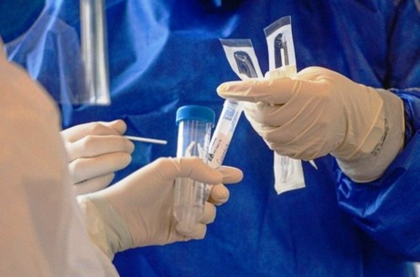 Mato Grosso registra 52.078 mil casos da Covid 19 e 1.842 mortes na sexta feira, 31