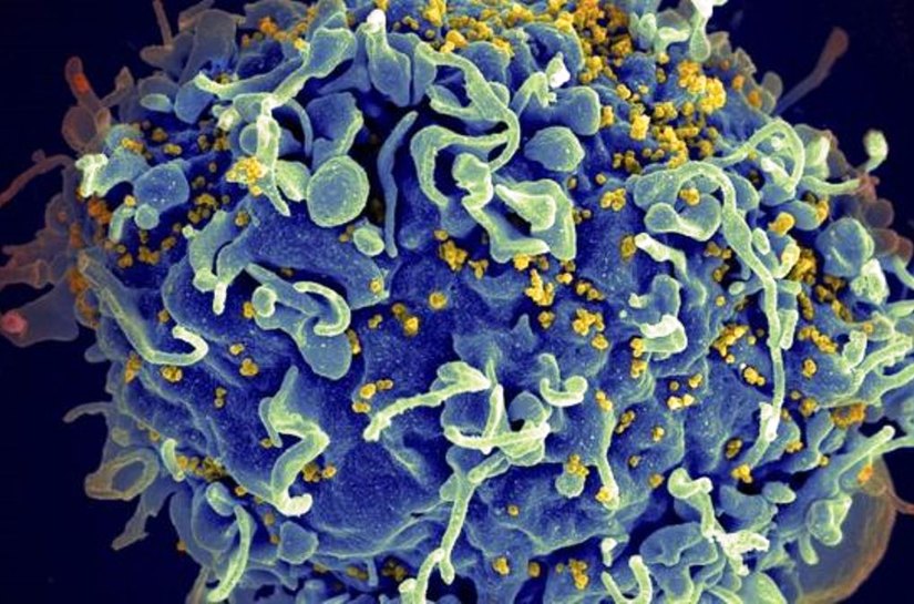Variante do HIV mais transmissível e agressiva é encontrada na Holanda