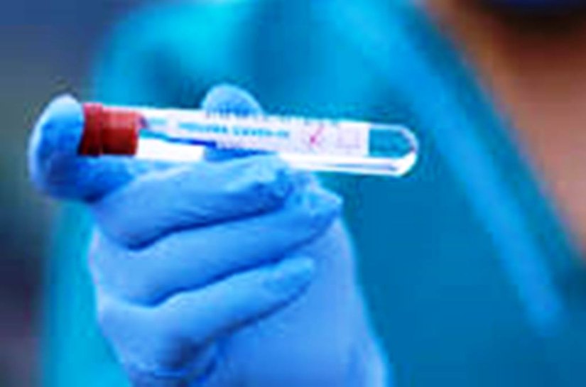 Mato Grosso tem 156.937 mil casos e 4.111 mil mortes nesta quarta feira, 25