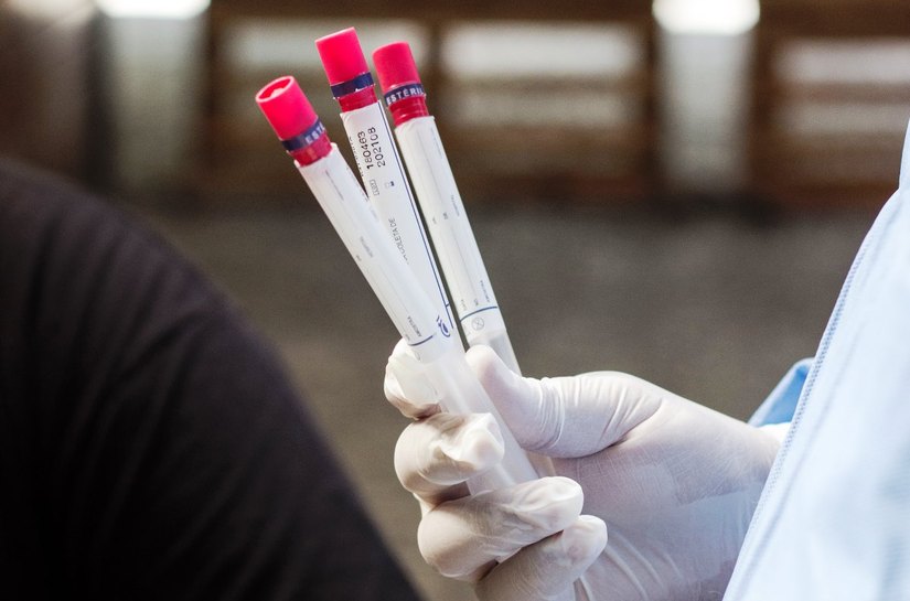 Anticorpos para o coronavírus diminuem com o tempo, diz estudo