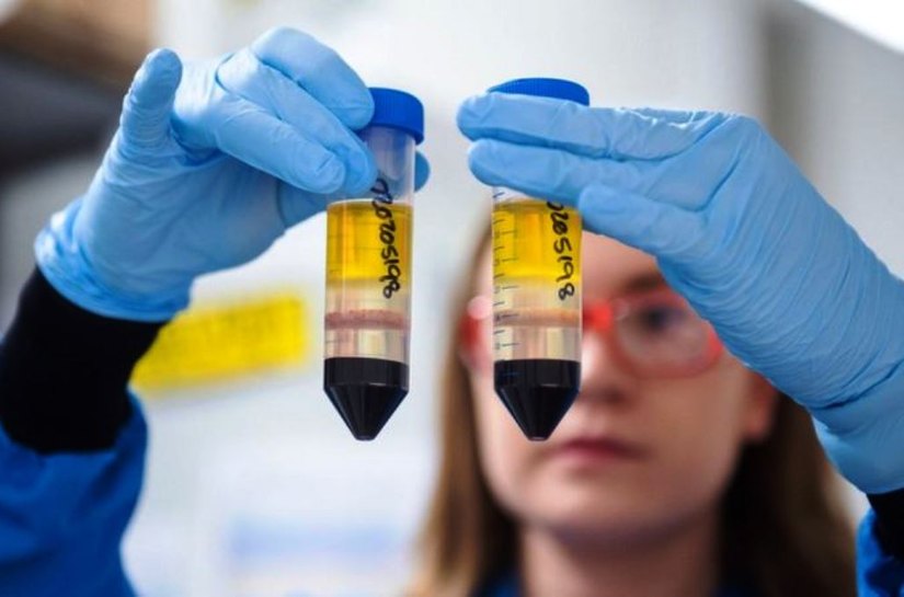 10 anos em 10 meses: como cientistas de Oxford criaram em tempo recorde um novo modelo de vacina contra o coronavírus