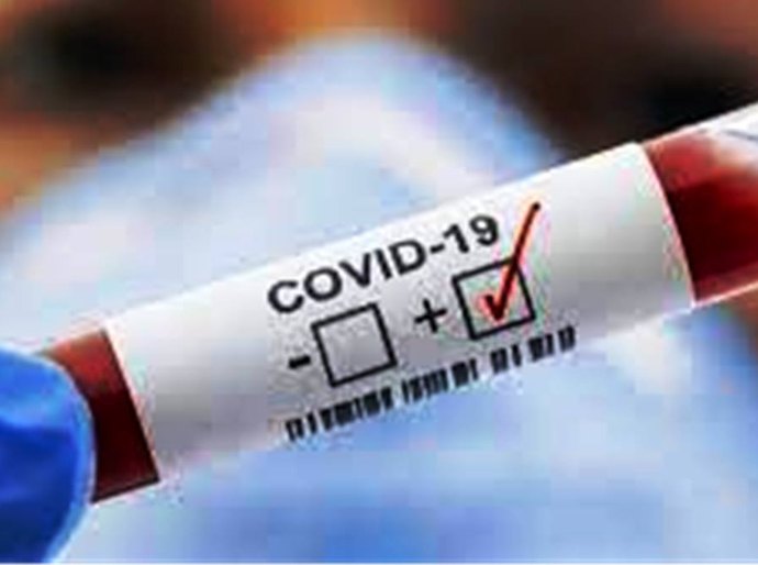 MT registra até segunda feira, 03, 365.406 mil casos da Covid 19 e 9.901 mil mortes
