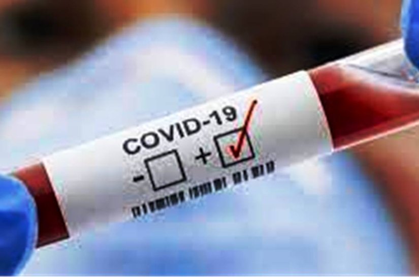 MT registra 514.097 mil casos da Covid 19 e 13.374 mil mortes até terça feira, 24