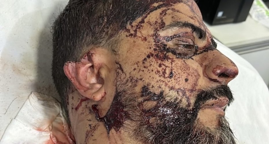 TERROR DENTRO DE CASA: criminosos exigem R$ 1 milhão, cortam orelha de vereador e ameaçam filho em Rondonópolis,MT