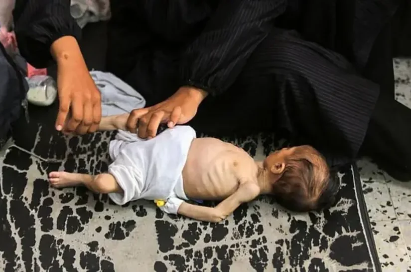 'Pais estão famintos demais para cuidar das crianças': a corrida para liberar ajuda humanitária em Gaza