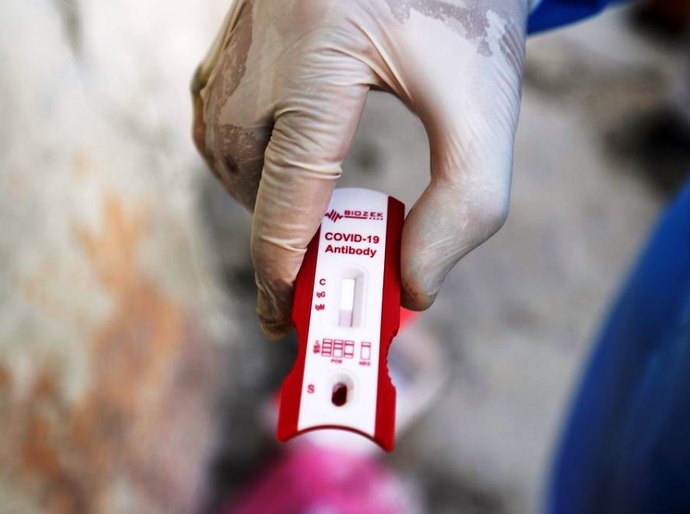 Covid-19: Brasil chega a 47,7 mil mortes e 978,1 mil casos confirmados