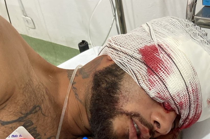 Explosão atinge em cheio o rosto de borracheiro e deixa jovem desacordado em Várzea Grande