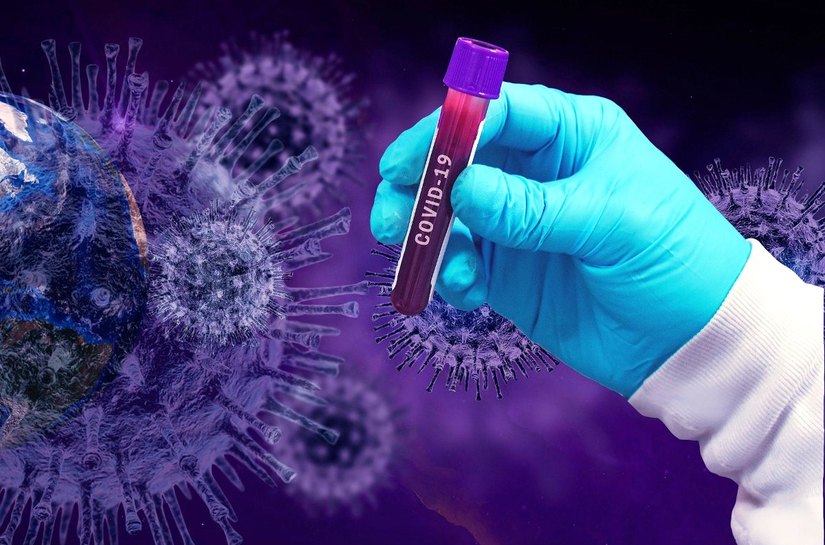 Mato Grosso tem 95.233 mil casos e 2.868 mortes pela Covid-19 nesta quarta feira, 02