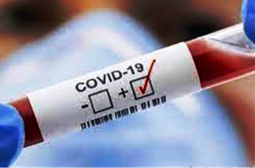 MT registra 506.310 mil casos da Covid 19 e 13.204 mil mortes, até segunda feira, 16