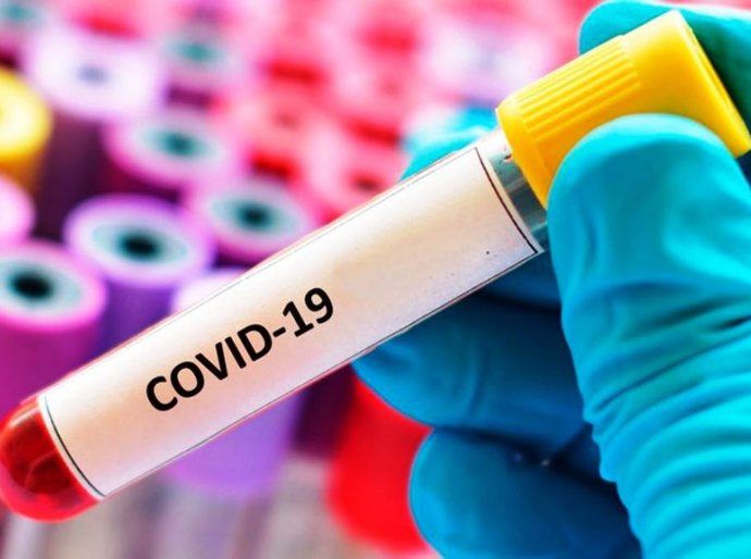 MT registra até segunda feira, 20, 555.572 mil casos da Covid 19 e 14.033 mil mortes