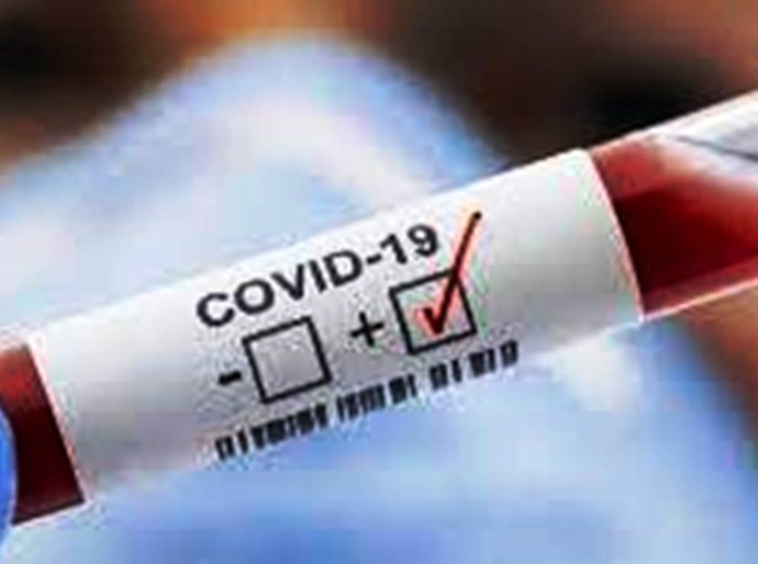 MT tem até sábado, 27, 301.454 mil casos da Covid 19 e 7.305 mil mortes