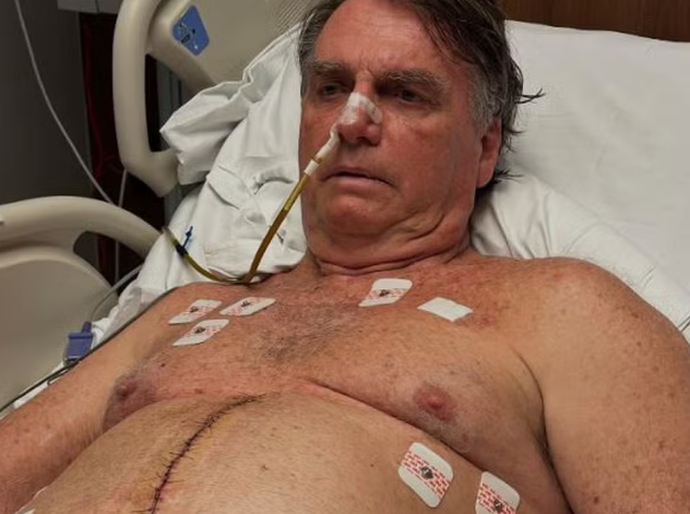Bolsonaro completa uma semana pós-cirurgia com 'pressão controlada', mas segue na UTI sem previsão de alta