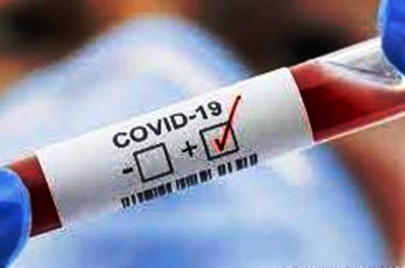 MT tem 381.930 mil casos da Covid 19 e 10.383 mil mortes, até sábado, 15