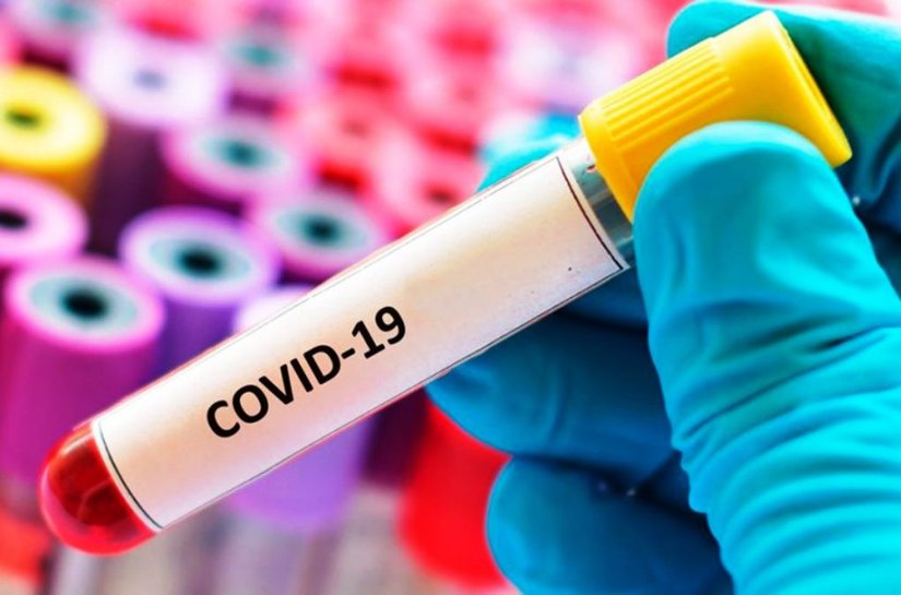 MT registra até segunda feira, 20, 555.572 mil casos da Covid 19 e 14.033 mil mortes
