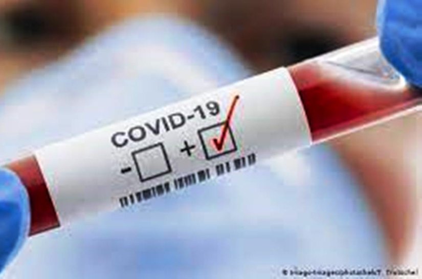 MT registra até quinta feira, 08, 324.899 mil casos da Covid 19 e 8.403 mil mortos