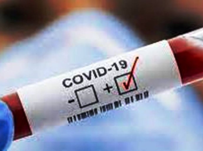 MT registra 384.443 mil casos da Covid 19 e 10.464 mil mortes, nesta segunda, 17
