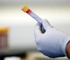Como interpretar um exame de sangue?