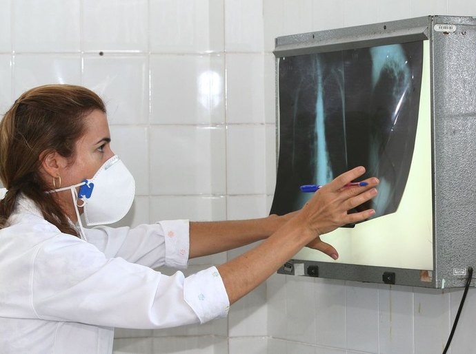 Com aumento de 5%, Brasil registra 78 mil casos de tuberculose