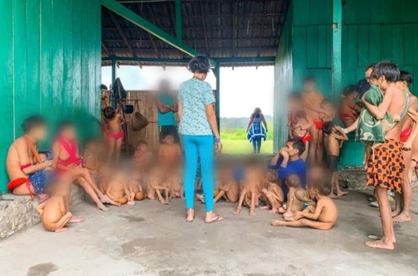 Criança Yanomami de quatro anos resgatada com desnutrição grave tem peso de bebê de oito meses