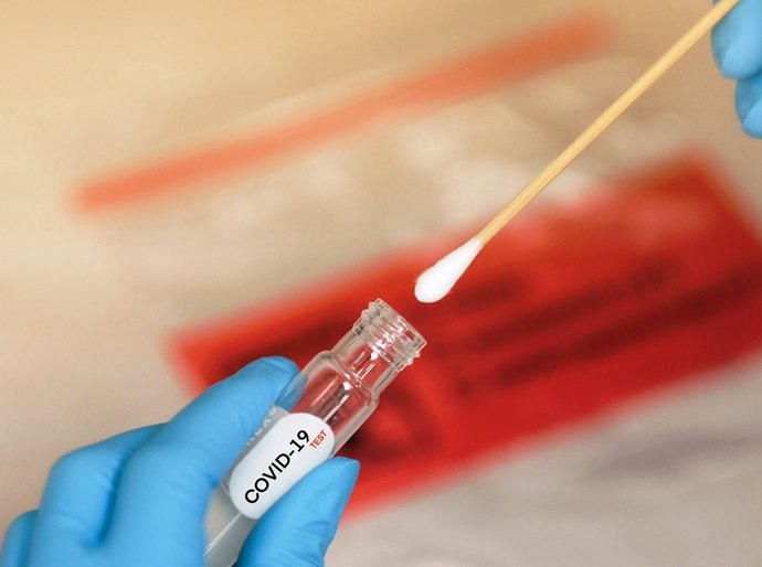 Brasil registra mais 33 mil casos e 739 mortes por Covid-19