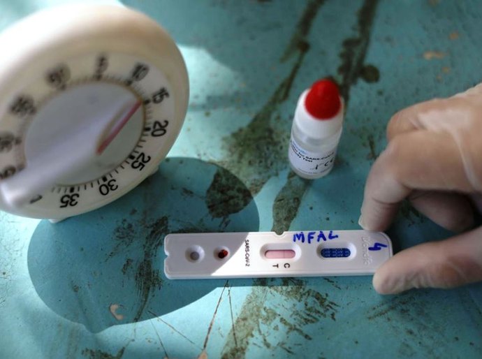 Covid-19: Brasil chega a 1,1 milhão de casos e 51,2 mil mortes