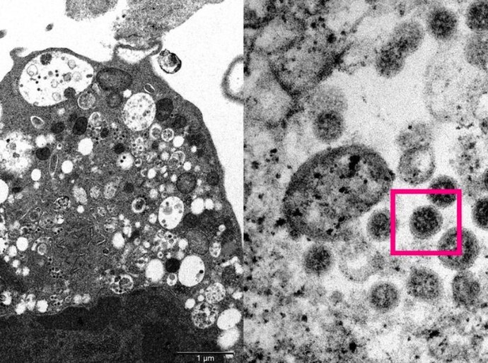 Cientistas capturam ômicron em 1ª imagem de microscópio