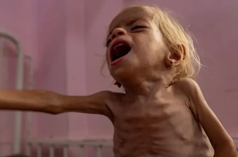 Fome é confirmada na Cidade de Gaza pela primeira vez, diz órgão ligado à ONU