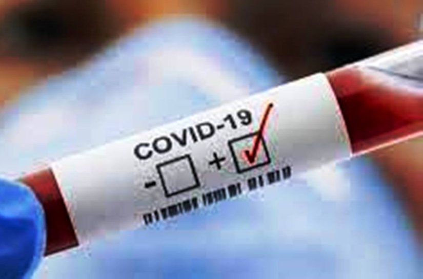 MT registra 363.366 mil casos da Covid 19 e 9.805 mil mortes até sábado, 01