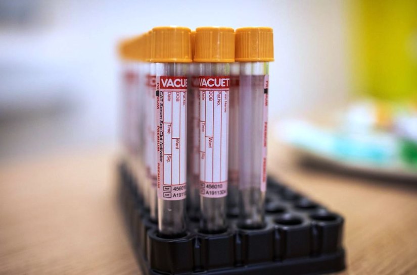 Covid-19: Brasil registra 552 óbitos e 30.476 novos casos da doença