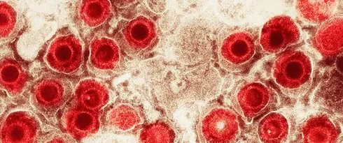 Vírus comuns podem aumentar o risco de Alzheimer?