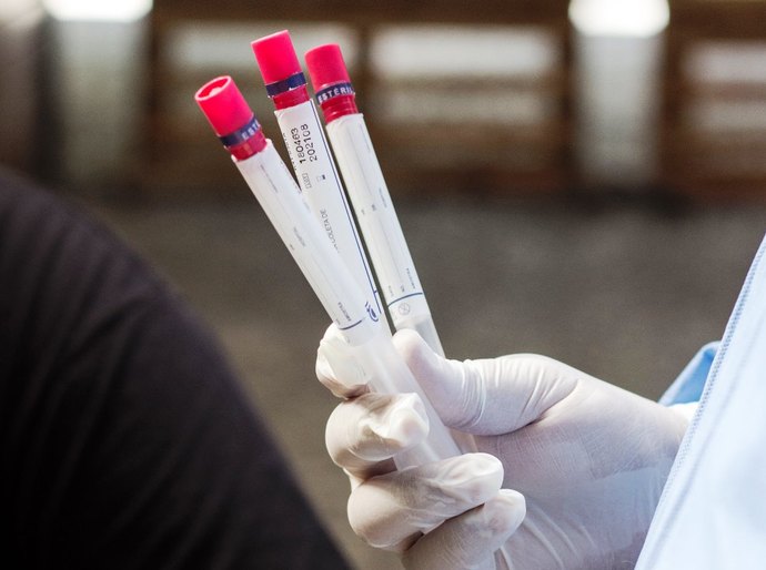 Anticorpos para o coronavírus diminuem com o tempo, diz estudo