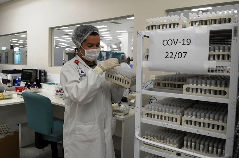 Covid-19: Brasil tem 97.256 óbitos e 2,02 milhões de recuperados