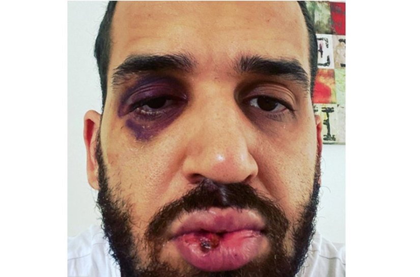 Médico é agredido por familiar após alertar sobre riscos da Covid-19, no Paraná: 'Dói, mas sinto que estou do lado que zela pela vida'