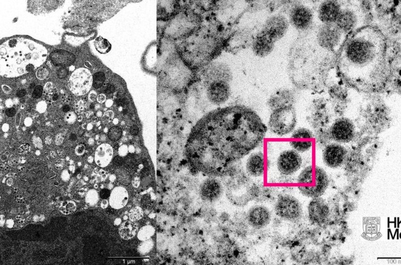 Cientistas capturam ômicron em 1ª imagem de microscópio