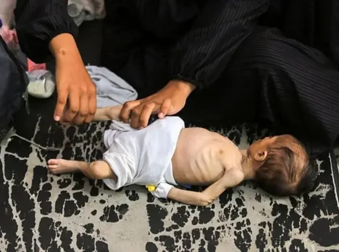 'Pais estão famintos demais para cuidar das crianças': a corrida para liberar ajuda humanitária em Gaza